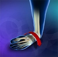 Ankle Instability